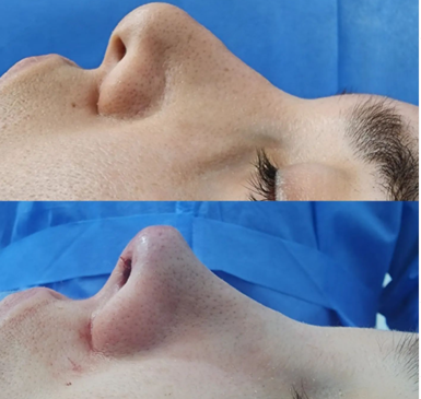 Slider image (8) Dr. Juan Sanabria Plastic Surgeon